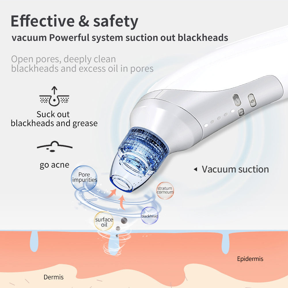 Blackhead Suction Instrument, Electric Blackhead Suction Artifact, Blackhead Removal Instrument, Home Use Beauty Instrument for Sucking Blackheads and Acne
